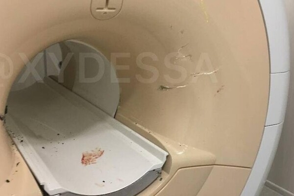 В Одессе пациента на инвалидном кресле засосало в МРТ-сканер: пострадали двое человек