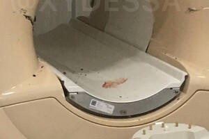 В Одессе пациента на инвалидном кресле засосало в МРТ-сканер: пострадали двое человек