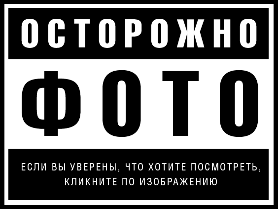 Житель Раздельной подорвал себя гранатой из-за ссоры с возлюбленной 