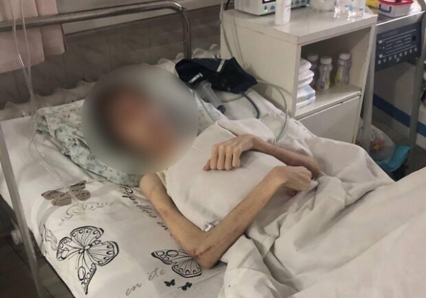 Гематомы и странное масло: отец, моривший голодом 16-летнего одессита, рассказал о порче
