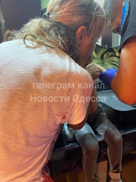 В Одессе на ребенка в ресторане упали двери
