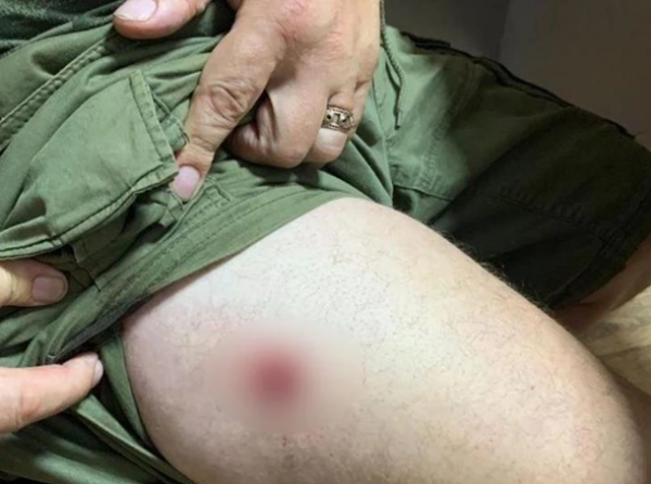 В Киевской области стреляли из-за места в цирке