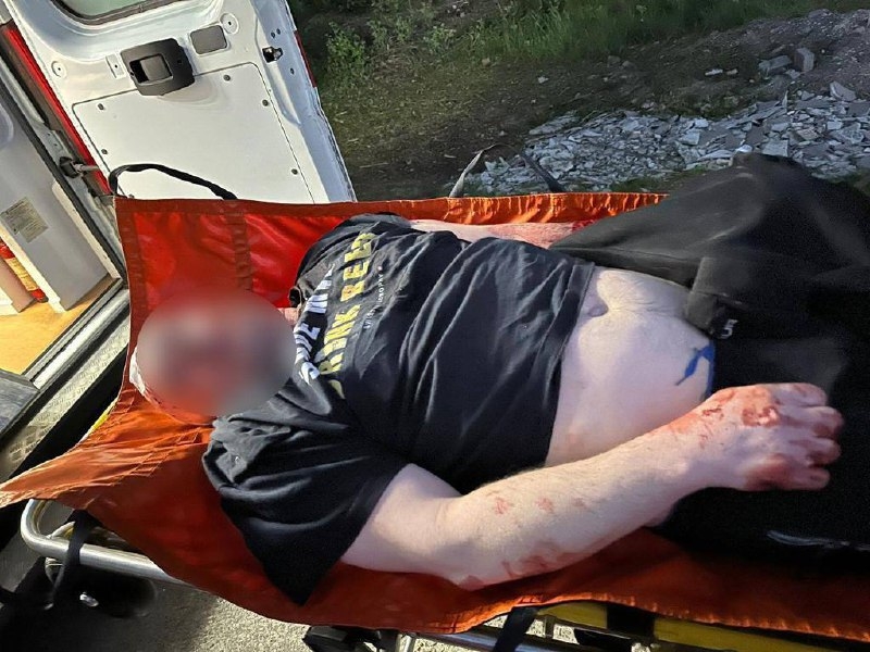 Убив 16-річну доньку і намагався накласти на себе руки: під Києвом розігралася кривава драма на грунті ревнощів (відео, фото 18+)