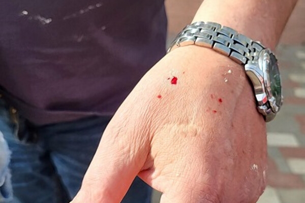 В Одессе полоз покусал директора зоопарка: куда обращаться, если заметили змею 