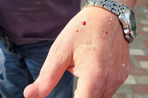 В Одессе полоз покусал директора зоопарка: куда обращаться, если заметили змею 