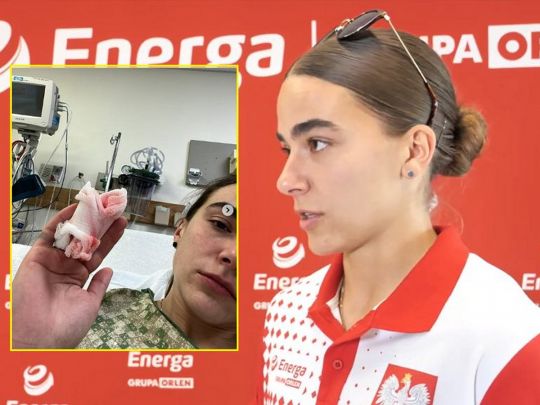 Відома бобслеїстка втратила частину пальця перед чемпіонатом світу (фото, відео)