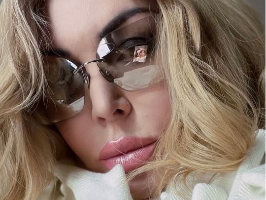 «Не впізнати, все штучне»: мережа розкритикувала новий кліп відомої співачки (фото, відео)